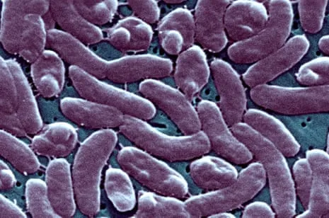 The Bayou State Records 5 Fatalities from Necrotizing Bacterium in Coastal Waters